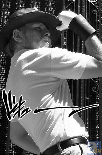 在线登录入口-【整形精品】茫茫人海一见钟情 玻尿酸让你走到哪里都是焦点(图4) 在线登录入口